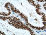 PAX8 Antibody in Immunohistochemistry (Paraffin) (IHC (P))