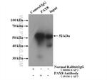 PAX8 Antibody in Immunoprecipitation (IP)