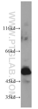 PAX8 Antibody in Western Blot (WB)