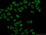 MAD2L1 Antibody in Immunocytochemistry (ICC/IF)