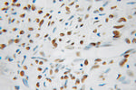 MAD2L1 Antibody in Immunohistochemistry (Paraffin) (IHC (P))