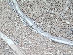 MAD2L1 Antibody in Immunohistochemistry (Paraffin) (IHC (P))