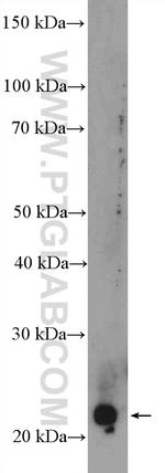 MAD2L1 Antibody in Western Blot (WB)