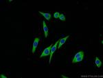 Melanophilin Antibody in Immunocytochemistry (ICC/IF)