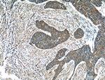 Melanophilin Antibody in Immunohistochemistry (Paraffin) (IHC (P))