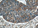 Melanophilin Antibody in Immunohistochemistry (Paraffin) (IHC (P))