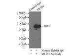 Melanophilin Antibody in Immunoprecipitation (IP)