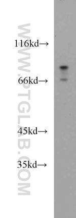 Melanophilin Antibody in Western Blot (WB)