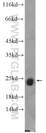 RAB6B Antibody in Western Blot (WB)