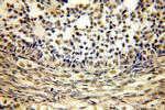 ACTL6A Antibody in Immunohistochemistry (Paraffin) (IHC (P))