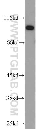 UBE3A Antibody in Western Blot (WB)