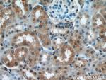 UBE3A Antibody in Immunohistochemistry (Paraffin) (IHC (P))