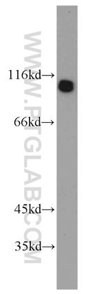 UBE3A Antibody in Western Blot (WB)