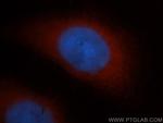 RNH1 Antibody in Immunocytochemistry (ICC/IF)