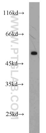 CTBP2 Antibody in Western Blot (WB)