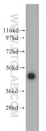 CTBP2 Antibody in Western Blot (WB)