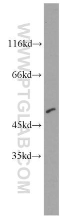 CTBP2 Antibody in Western Blot (WB)