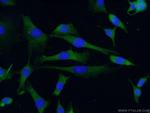 RAB4A Antibody in Immunocytochemistry (ICC/IF)