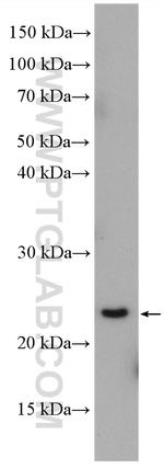 RAB4A Antibody in Western Blot (WB)