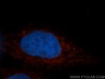 STOML2 Antibody in Immunocytochemistry (ICC/IF)