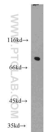 NCBP1 Antibody in Western Blot (WB)