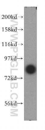 NCBP1 Antibody in Western Blot (WB)