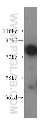 NCBP1 Antibody in Western Blot (WB)