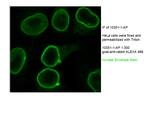 Emerin Antibody in Immunocytochemistry (ICC/IF)