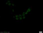 Emerin Antibody in Immunocytochemistry (ICC/IF)