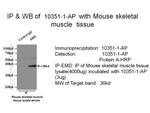 Emerin Antibody in Immunoprecipitation (IP)