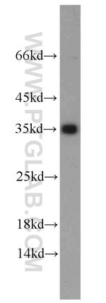 Emerin Antibody in Western Blot (WB)