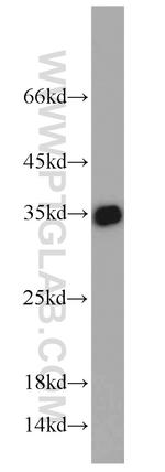 Emerin Antibody in Western Blot (WB)