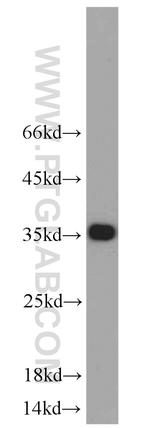 Emerin Antibody in Western Blot (WB)