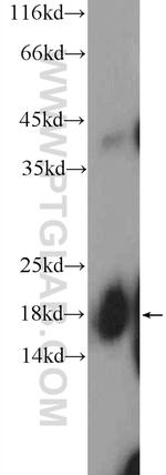 SNRPD1 Antibody in Western Blot (WB)