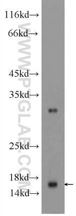 SNRPD1 Antibody in Western Blot (WB)