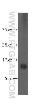 SNRPD1 Antibody in Western Blot (WB)