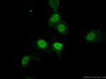 P21 Antibody in Immunocytochemistry (ICC/IF)