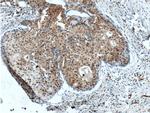 P21 Antibody in Immunohistochemistry (Paraffin) (IHC (P))