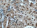 P21 Antibody in Immunohistochemistry (Paraffin) (IHC (P))