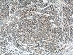 P21 Antibody in Immunohistochemistry (Paraffin) (IHC (P))