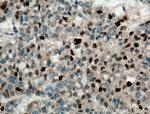 P21 Antibody in Immunohistochemistry (Paraffin) (IHC (P))