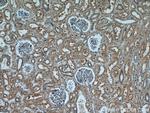 P21 Antibody in Immunohistochemistry (Paraffin) (IHC (P))