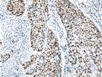 P21 Antibody in Immunohistochemistry (Paraffin) (IHC (P))