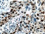 P21 Antibody in Immunohistochemistry (Paraffin) (IHC (P))