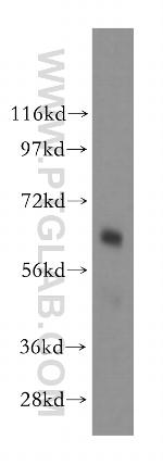 GGA2 Antibody in Western Blot (WB)