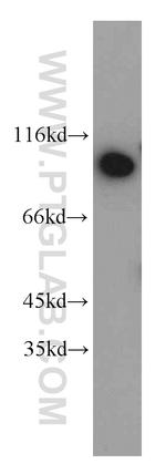 DDX50 Antibody in Western Blot (WB)