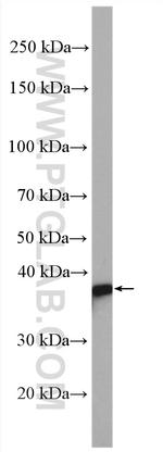 MAPRE2 Antibody in Western Blot (WB)