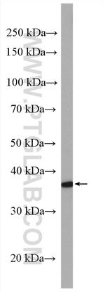 MAPRE2 Antibody in Western Blot (WB)