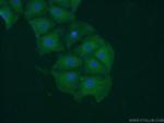 DKK3 Antibody in Immunocytochemistry (ICC/IF)