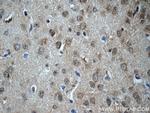 DKK3 Antibody in Immunohistochemistry (Paraffin) (IHC (P))